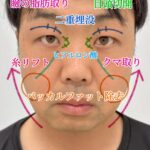 レス17番のサムネイル画像