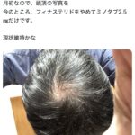 レス1番のサムネイル画像