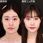 レス1番のサムネイル画像