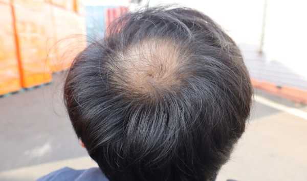 記事サムネイル