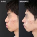 レス3番の画像1