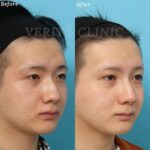 レス2番の画像1